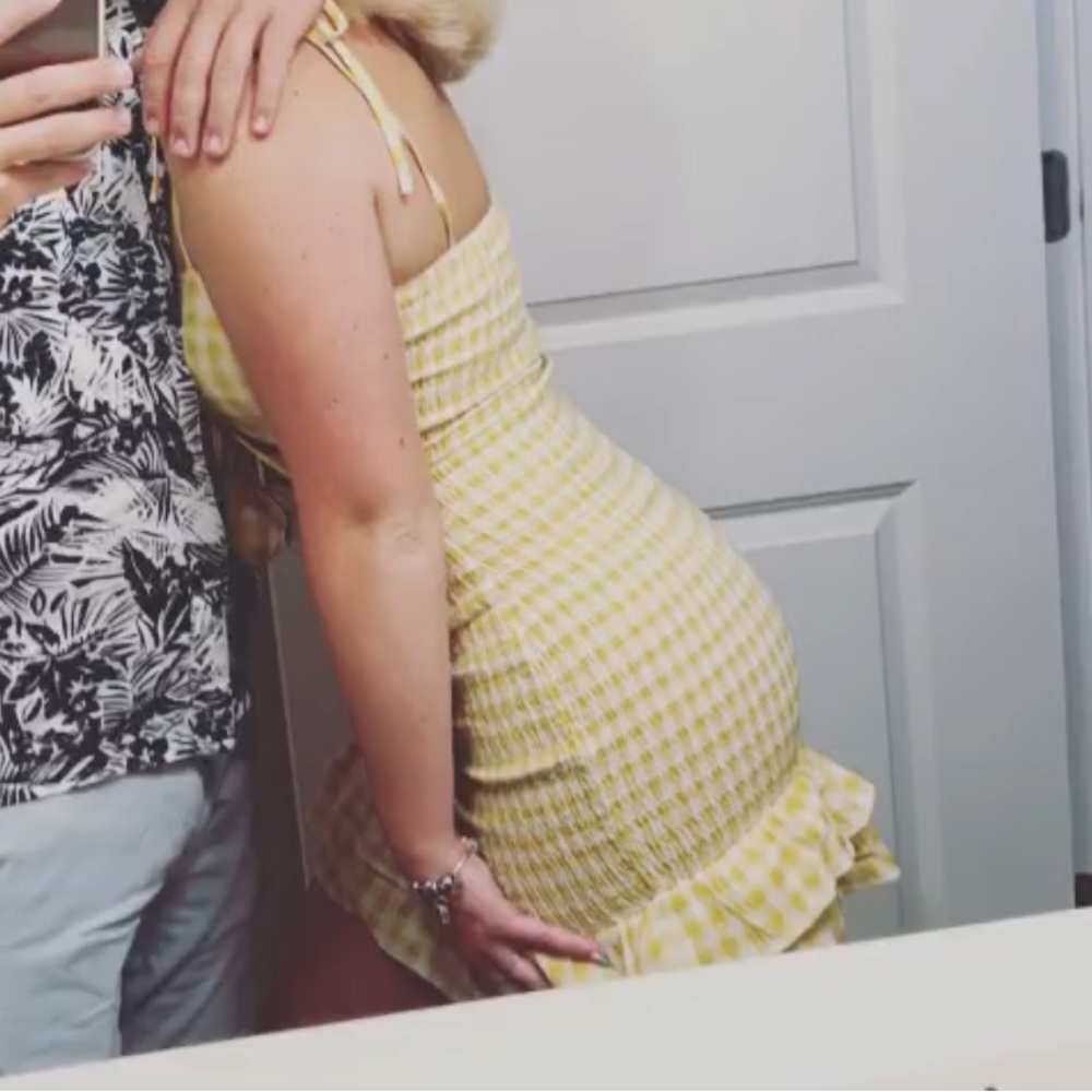 Yellow mini dress